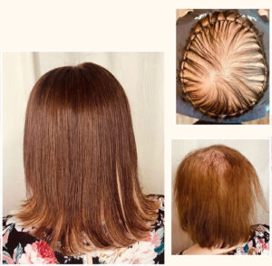 Zweithaarstudio Berlin - hochwertige Perücken und Haarverdichtung